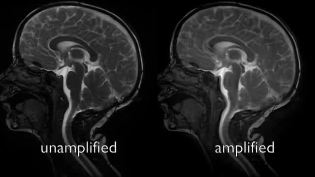 Head MRI